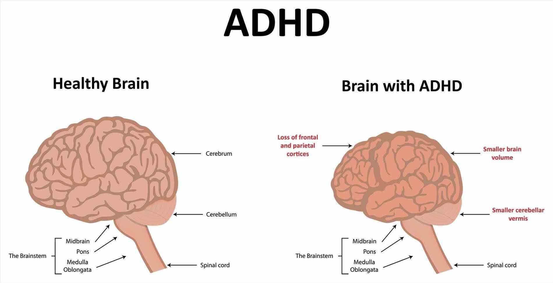 ADHD Nervous System Science Leadership Academy Beeber